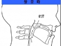 鼻音異常（Rhinolalia）