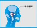 顳頜關節症候群（temporomandibular-joint syndrome）